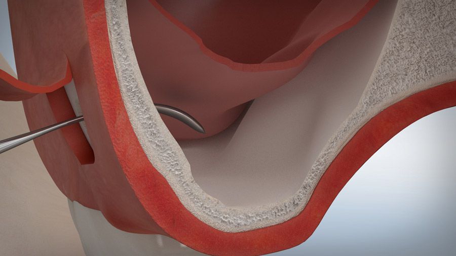 Smile-3D Smile-3D